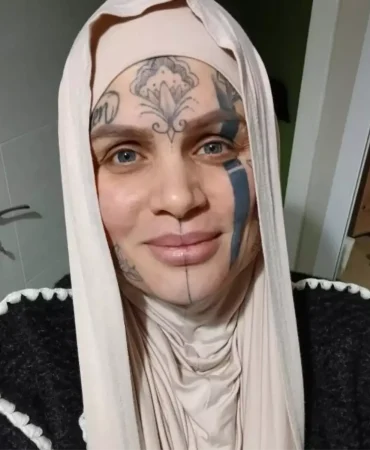 Yuzu-Dovmeli-Kadin-Gundemde-Hedefteki-Gencten-Aciklama-Geldi-featured